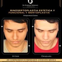 Enrique Serrano Cruz-11