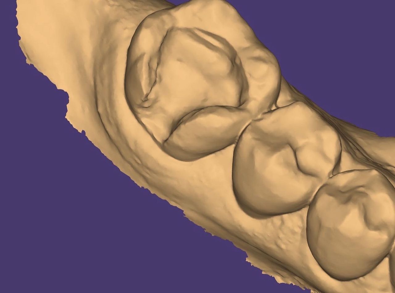 Ireri García Santana-11