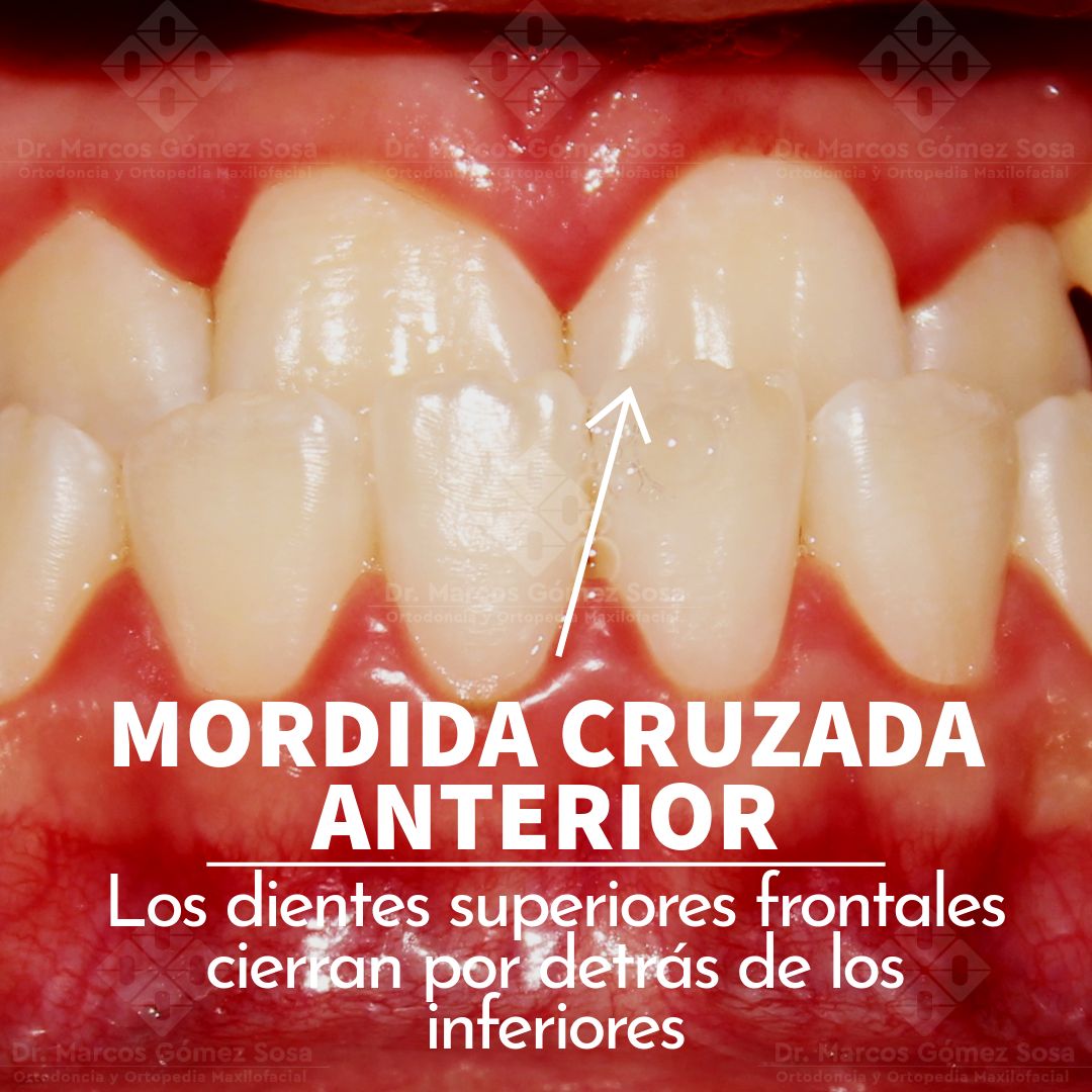 Marcos Gómez Sosa-72