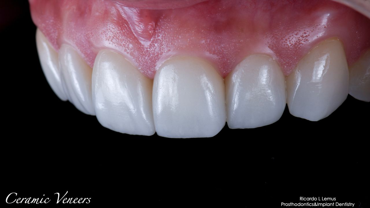 Ricardo López Lemus-100