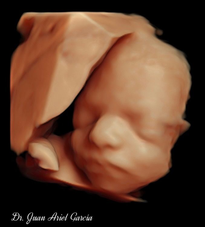 Juan Ariel Garcia Gonzalez-4