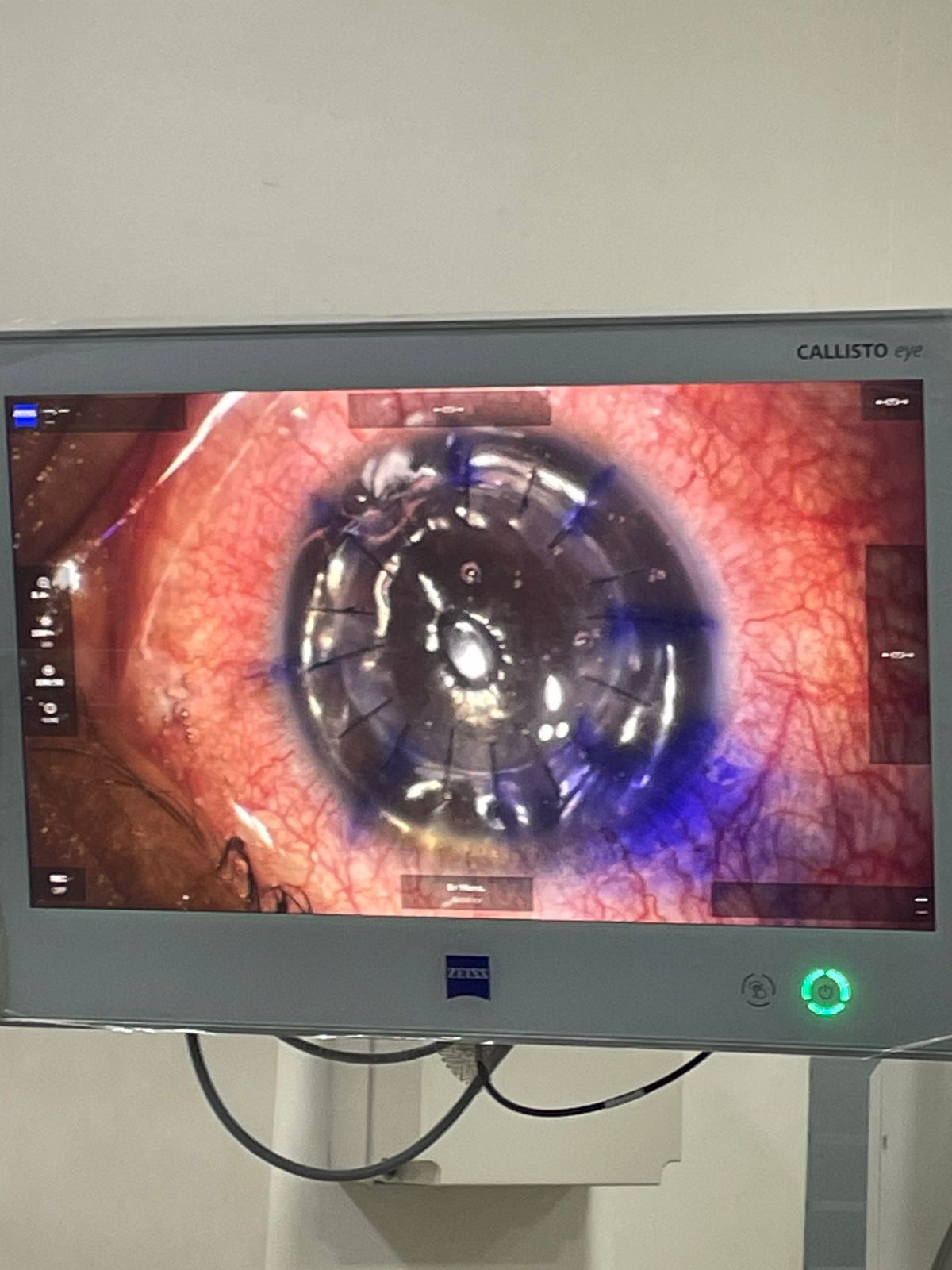 Erick Eduardo Mena Linares-7