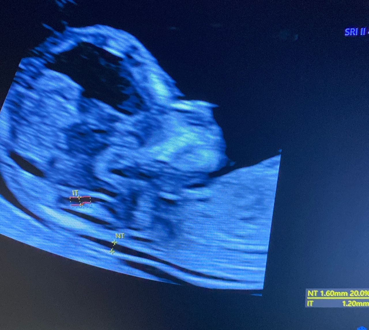 Andrés Murillo Mendoza-5