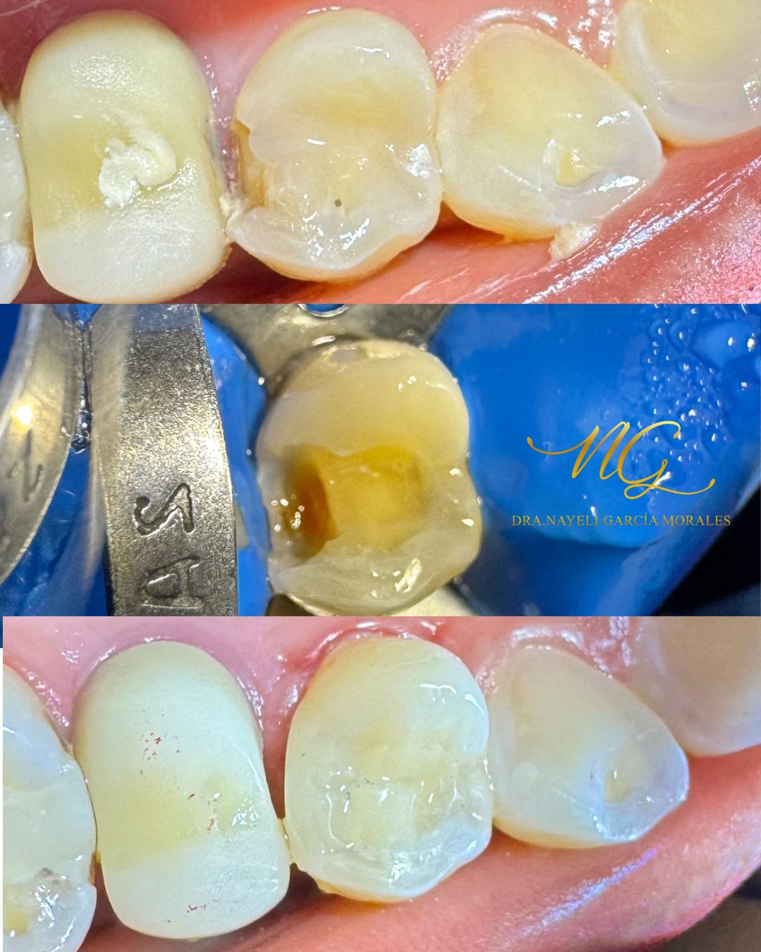 Nayeli Garcia Morales-9