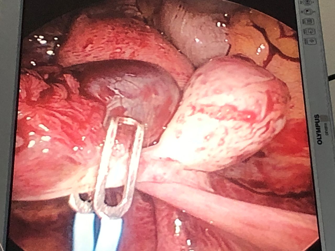 Lorena Balladares Macedo-10