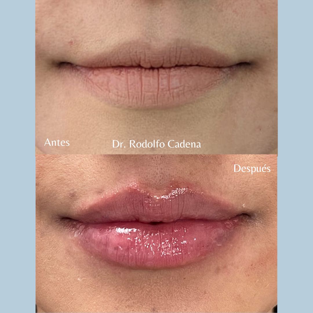 Rodolfo Cadena Garza-1