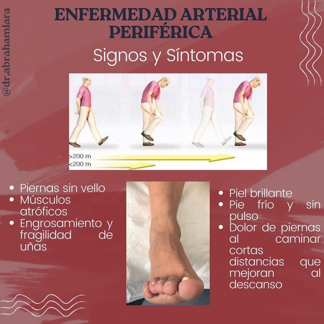 Miguel Abraham Lara Perez-30