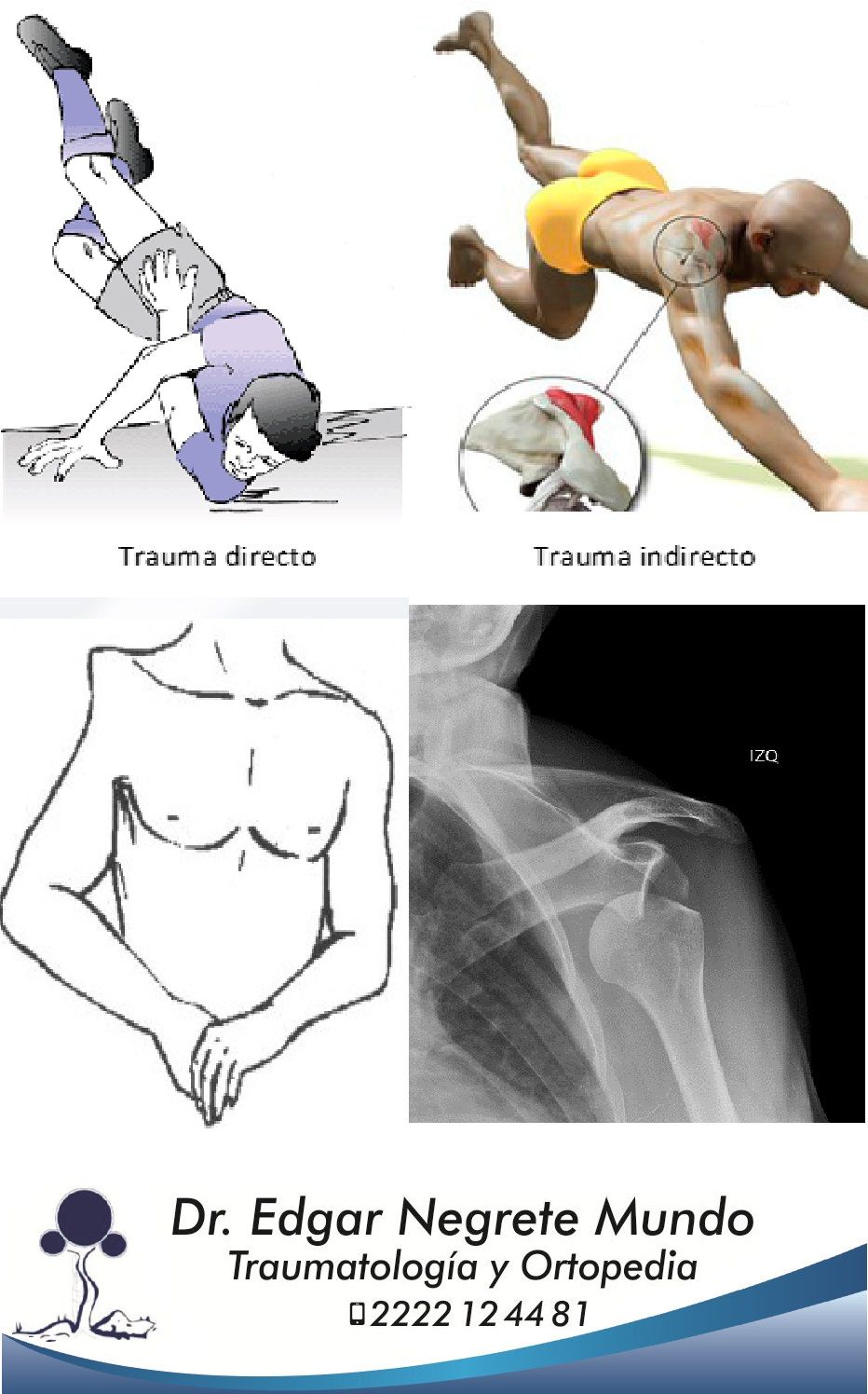 Edgar Negrete Mundo-7