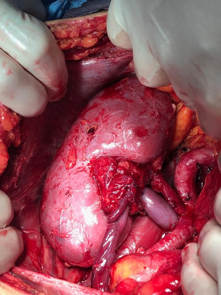 Juan Pablo Santos Uscanga-12