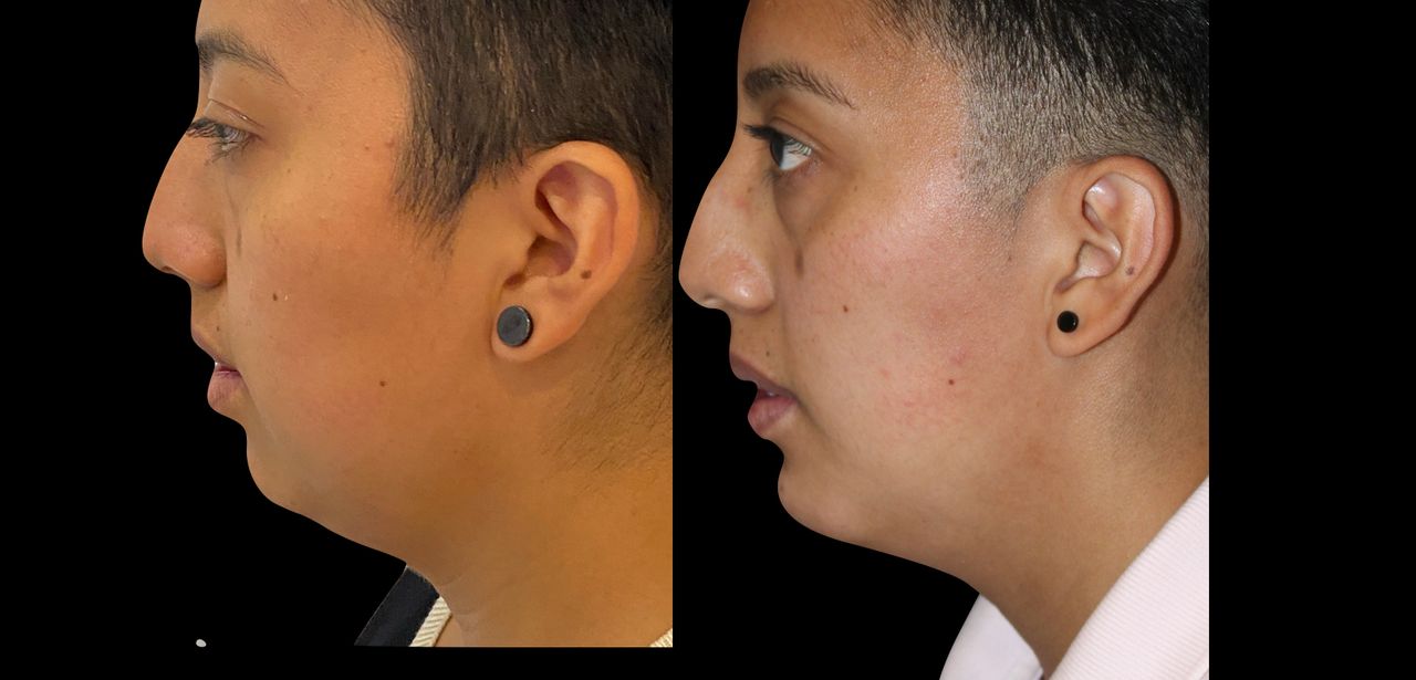 Giovani Ramírez Limón-13