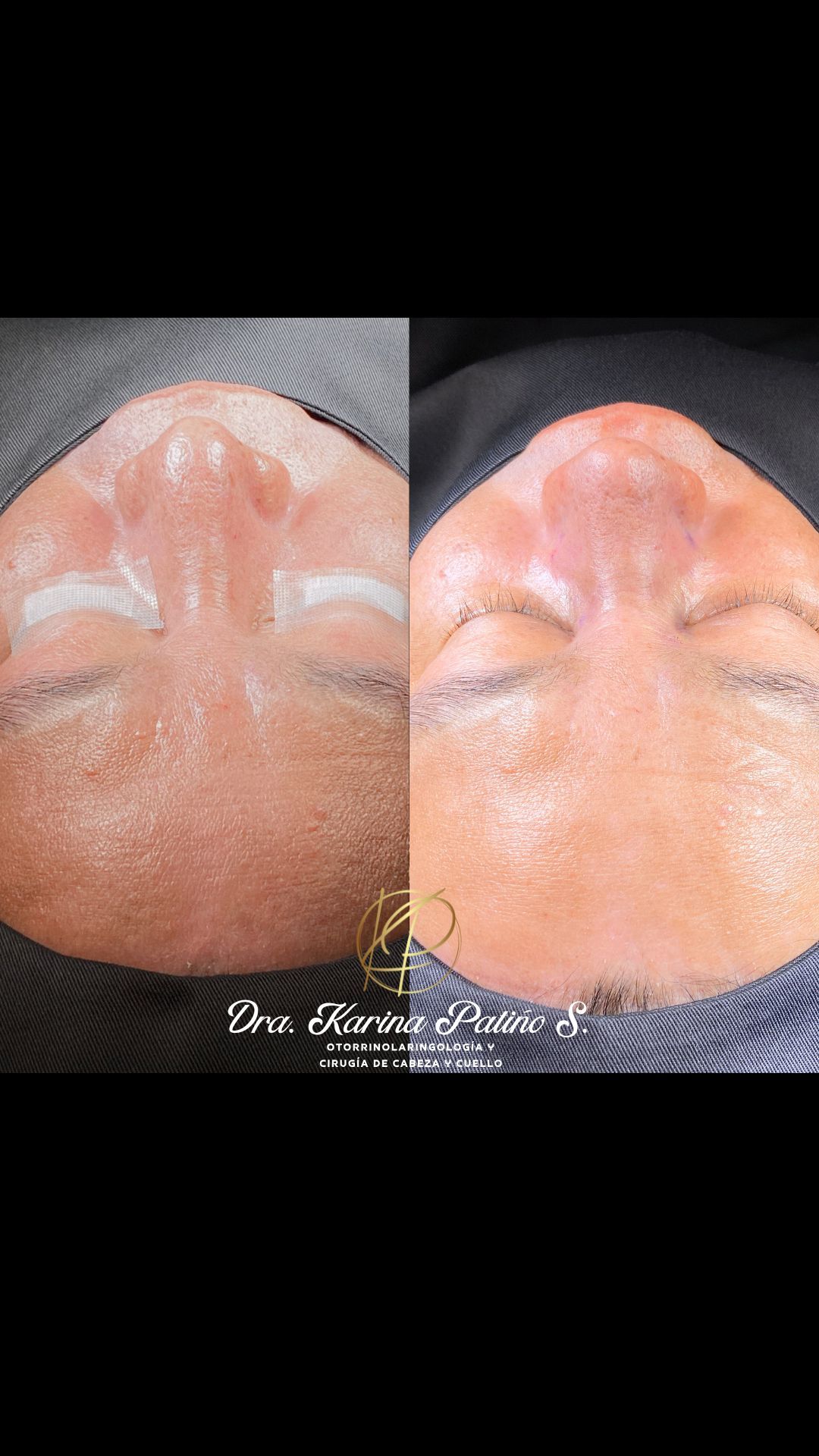 Karina Patiño S.-16