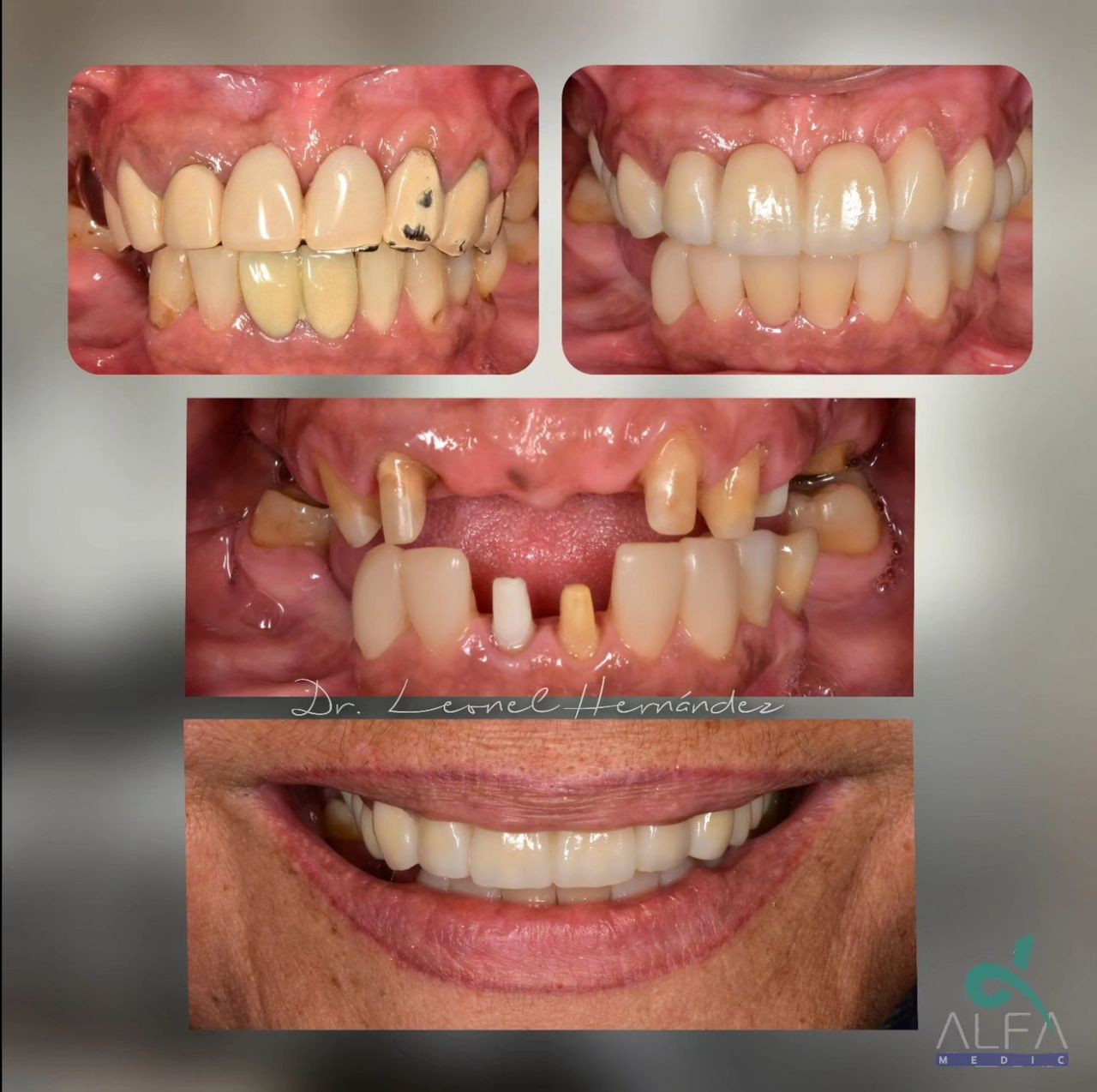 Leonel Hernández Gómez-7