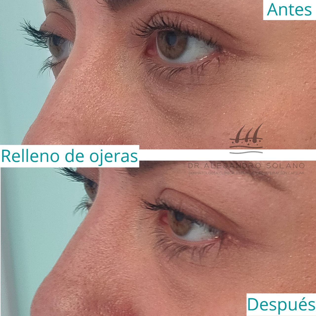 Oscar Alejandro Solano Anguiano-3