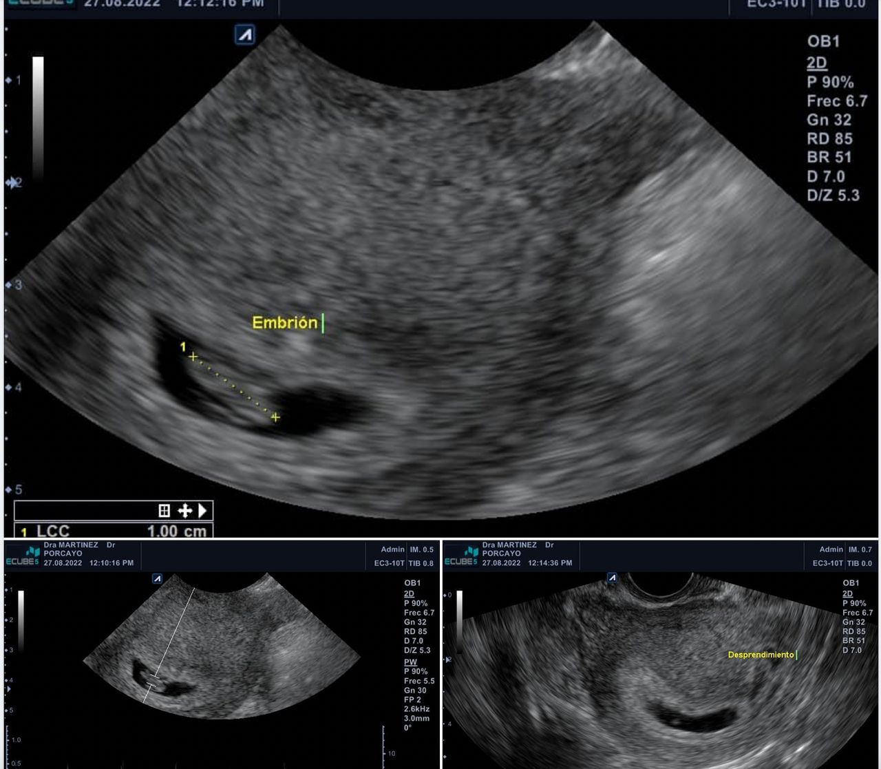 Joel Porcayo Garcia-13