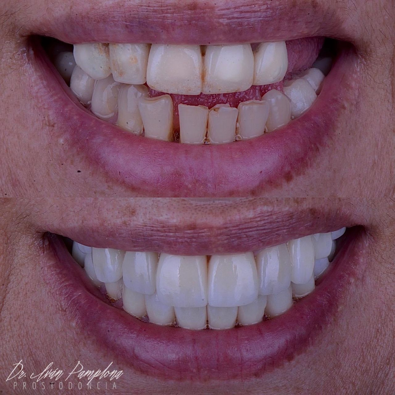 Iván Gerardo Pamplona Alfaro-17