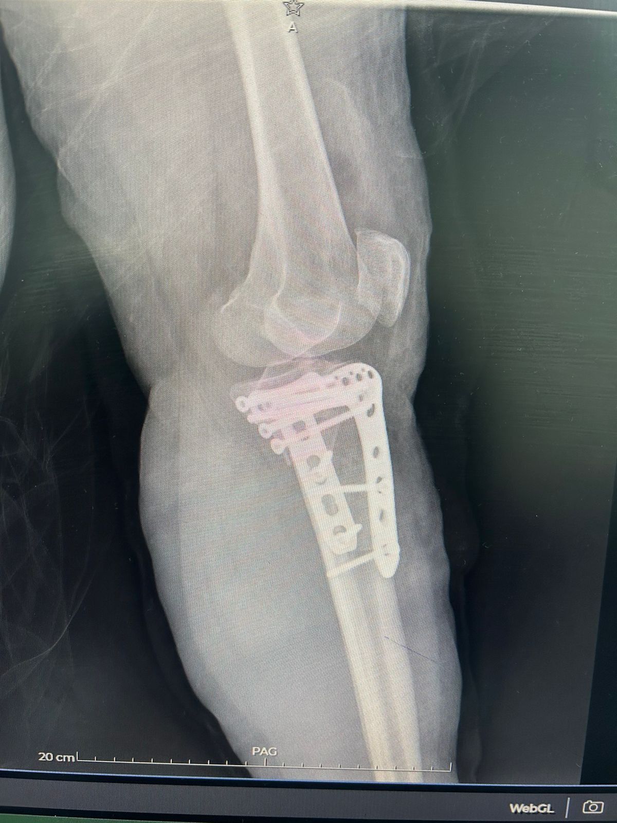 Leonardo Isaac Re-13