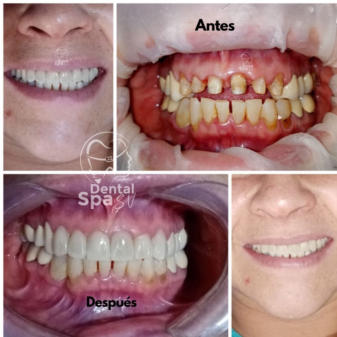 Zury Sarai Moreno Soto-31