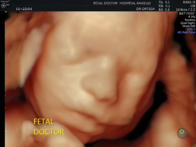 Jesús Manuel Ortega Flores-7