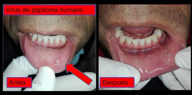 Diana Araceli Dávila Hernández-5