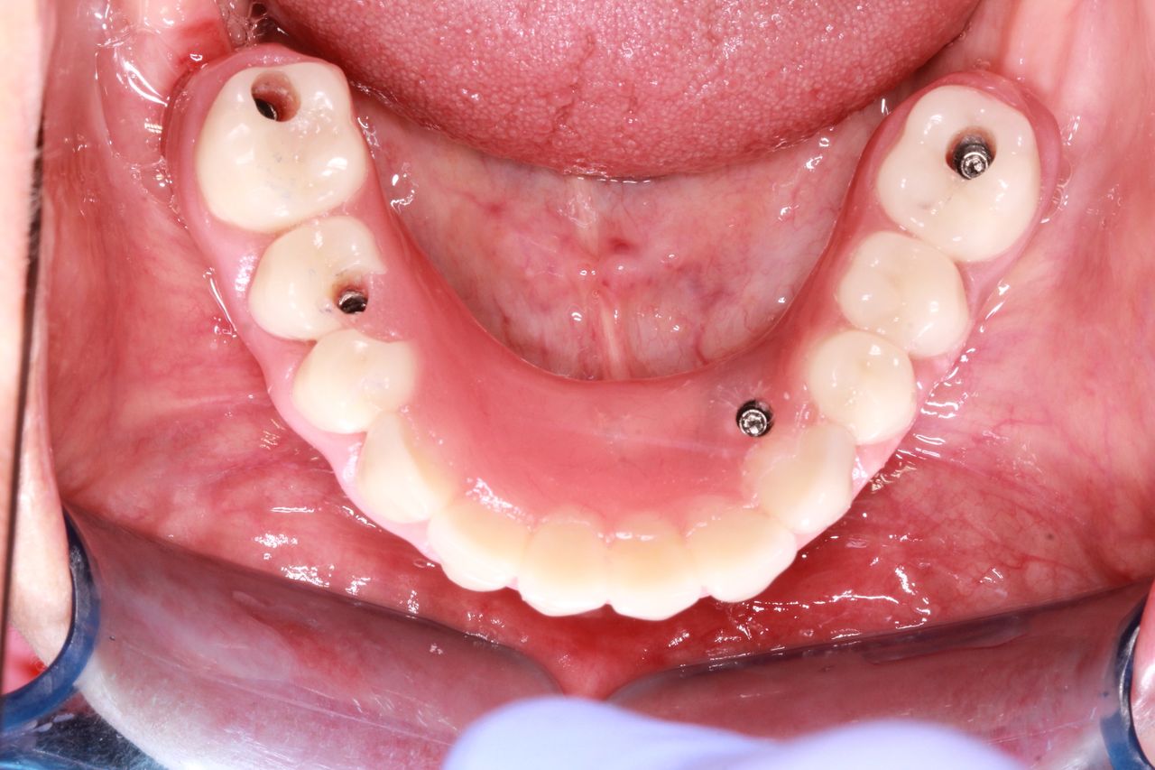 Heidi Mendoza Malagón-8