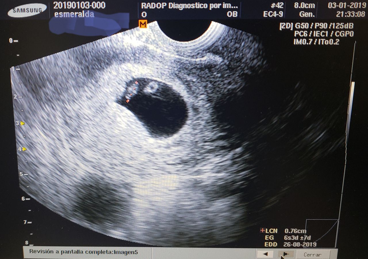 Germán Gabriel Palacios López-29