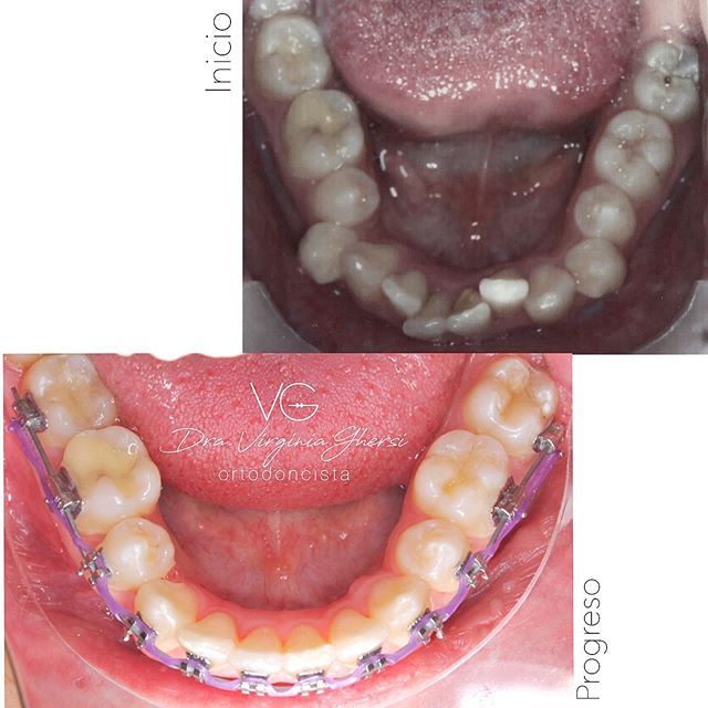 Maria Virginia Ghersi Angulo-5