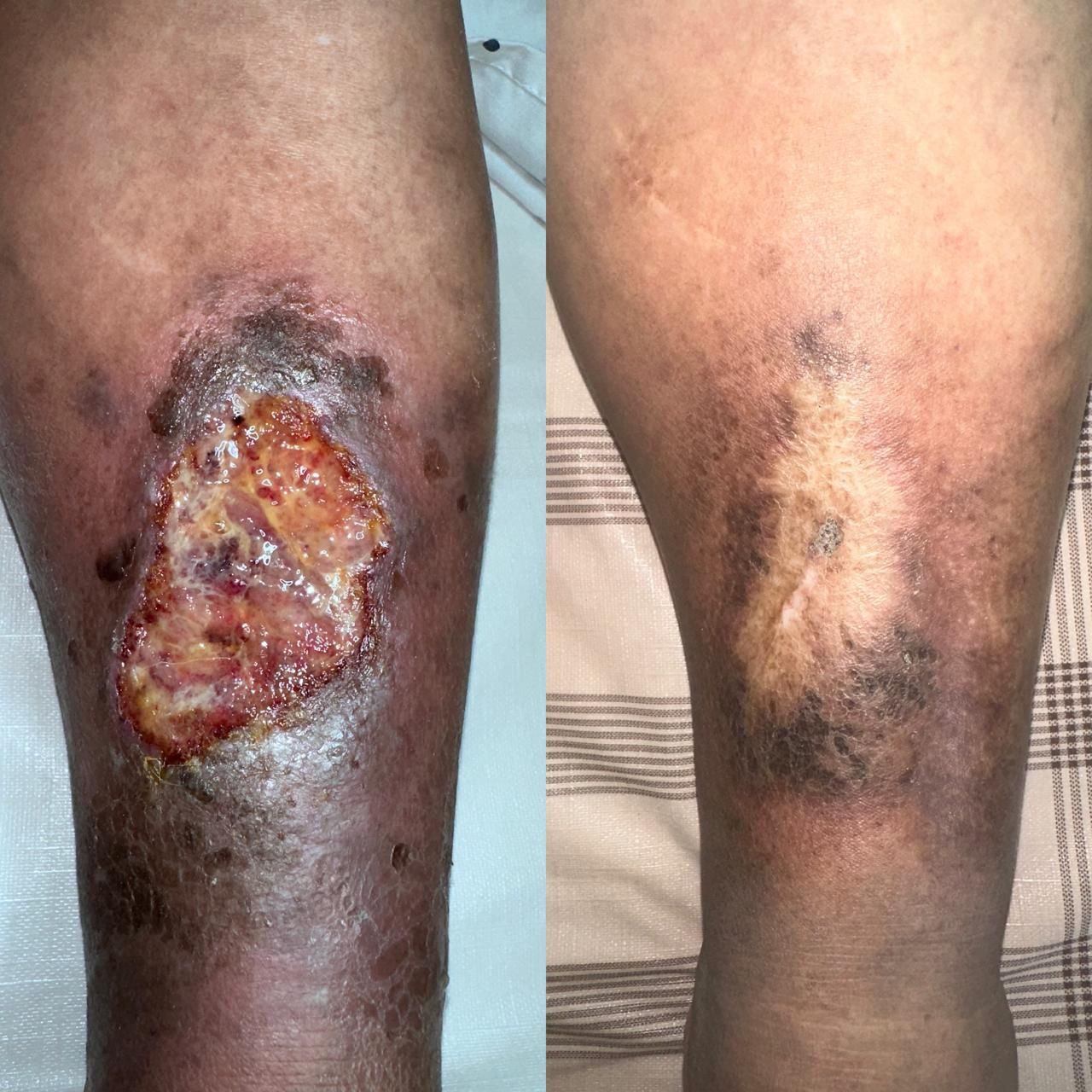 Jhonatan López González-42