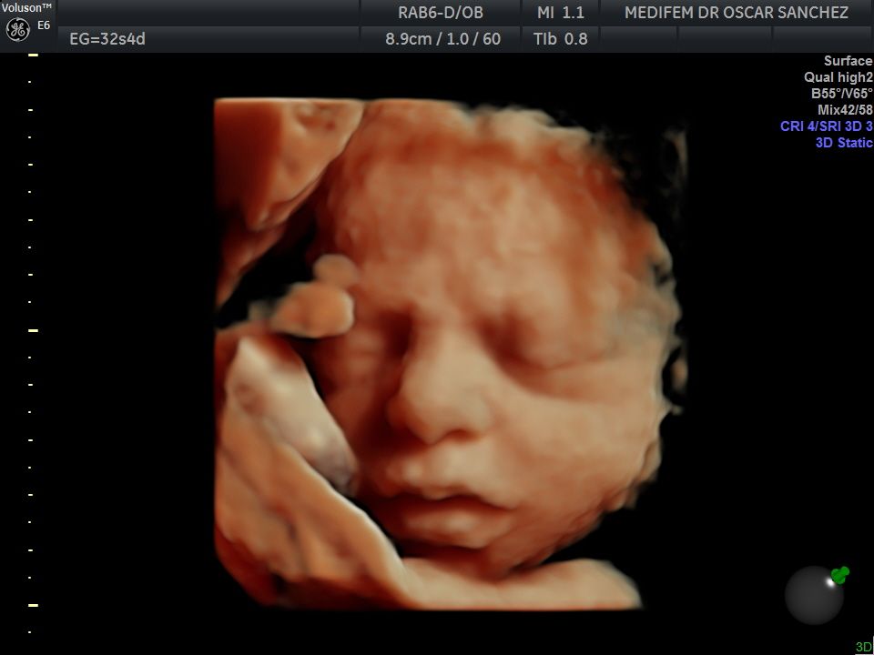 Oscar Alejandro Sánchez Gámez-9