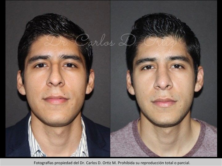 Carlos David Ortiz Moreno-53