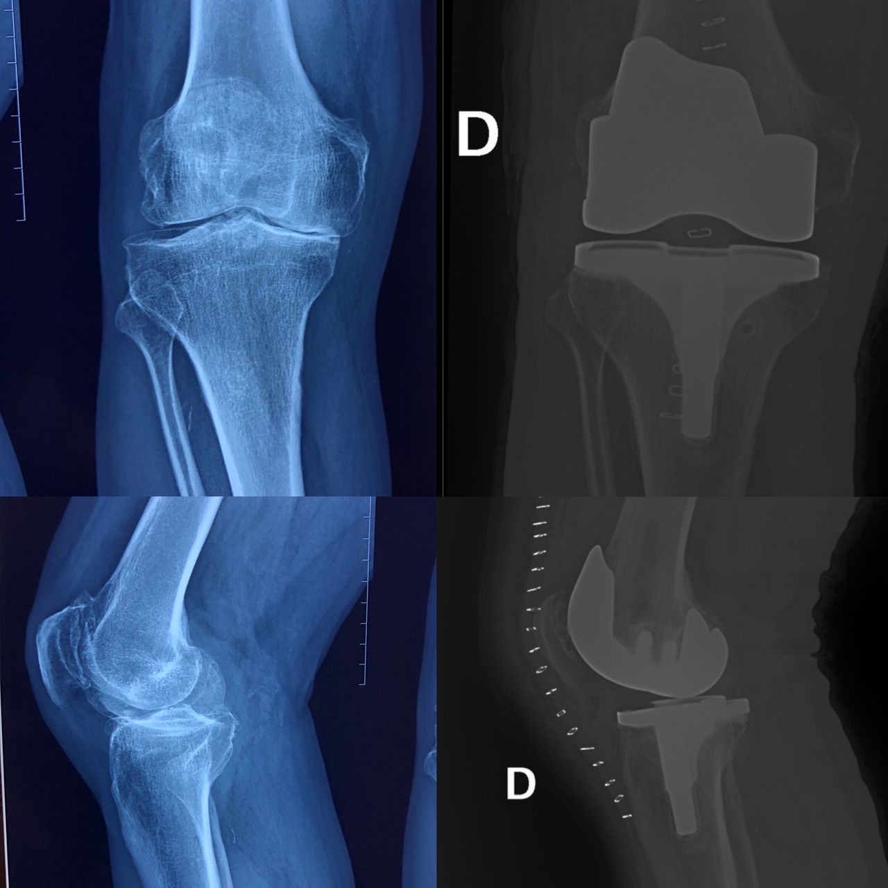 Carlos Ruben Baca Dominguez-0