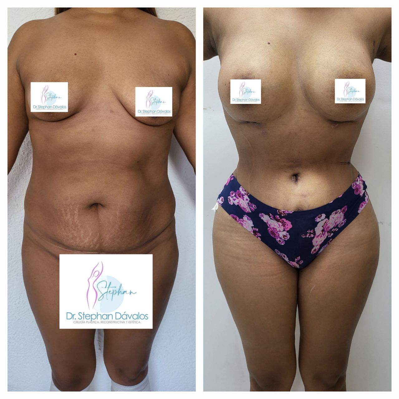 Stephan Dávalos Barrios-5