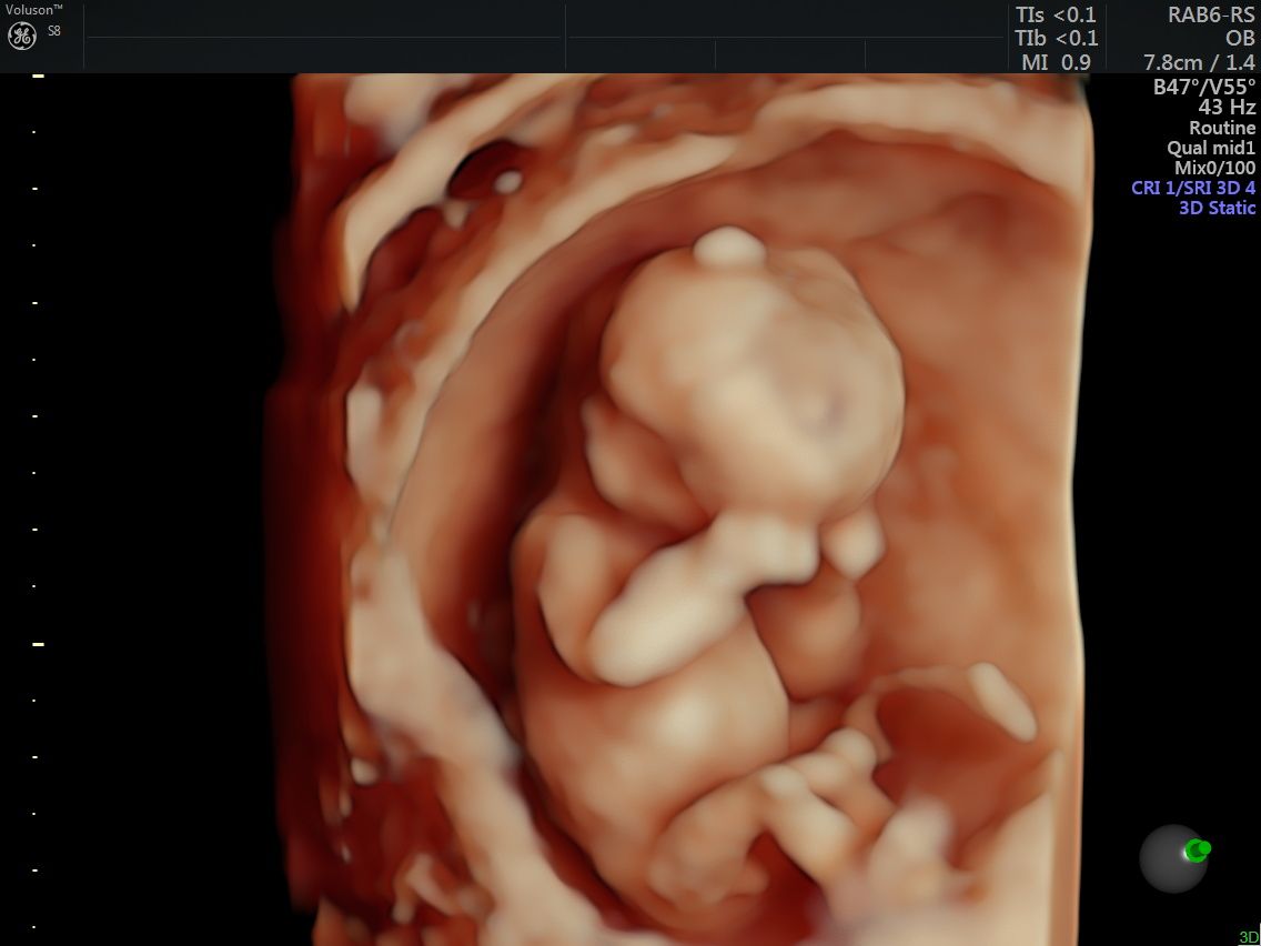 Griselda Reyes Torres-23