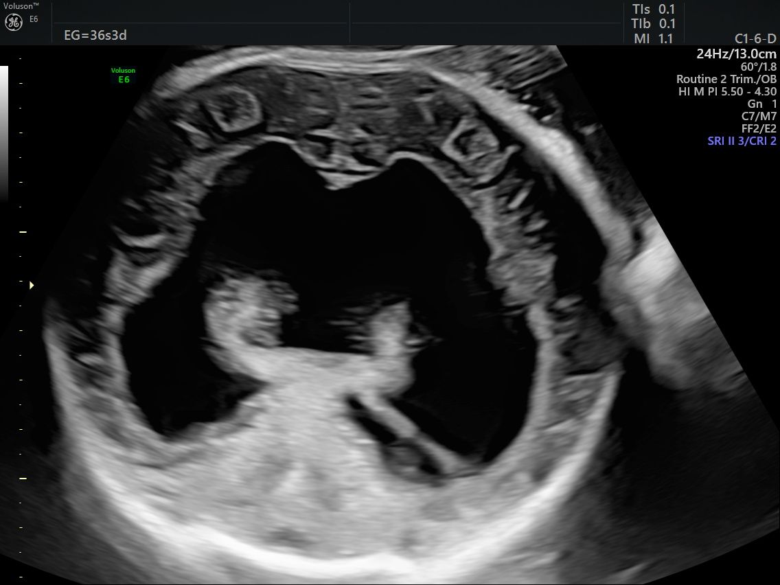Guillermo Abrego Rodríguez-12