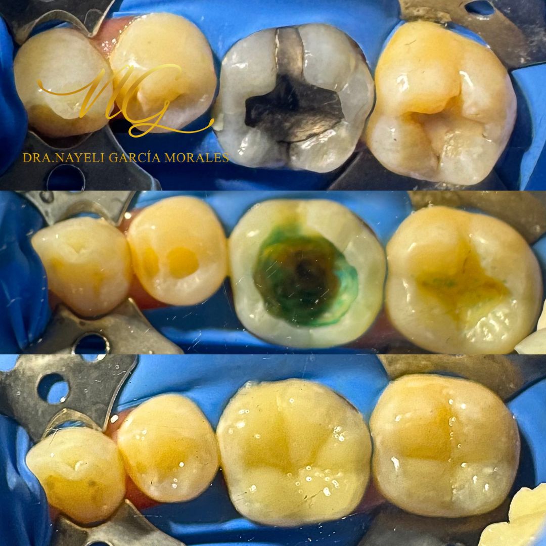 Nayeli Garcia Morales-10