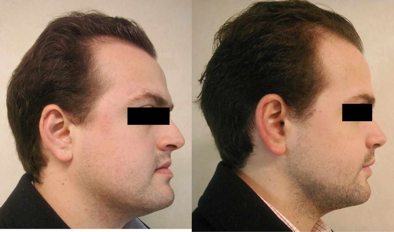 Gastón Porte Hinojosa-1