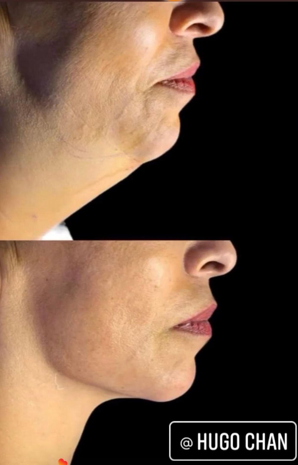 Nancy Valeria Lara Gayosso-17