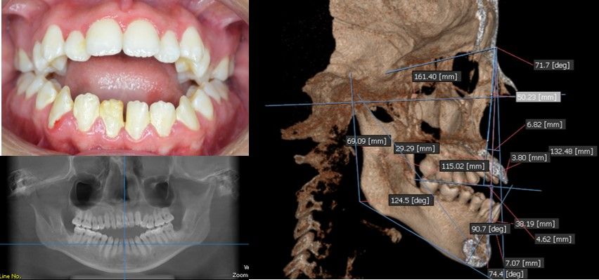 Valeria Xancopinca-7
