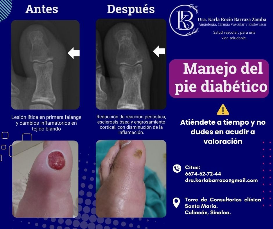 Karla Rocio Barraza Zambada-3