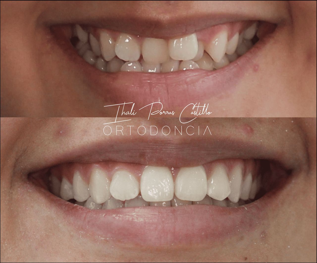 Ihali Porras Castillo-9