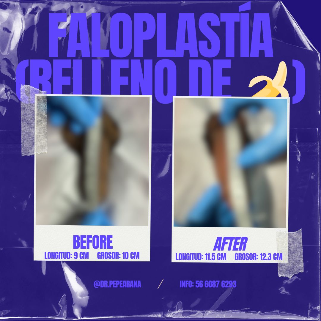 José Carlos Arana Barba-3