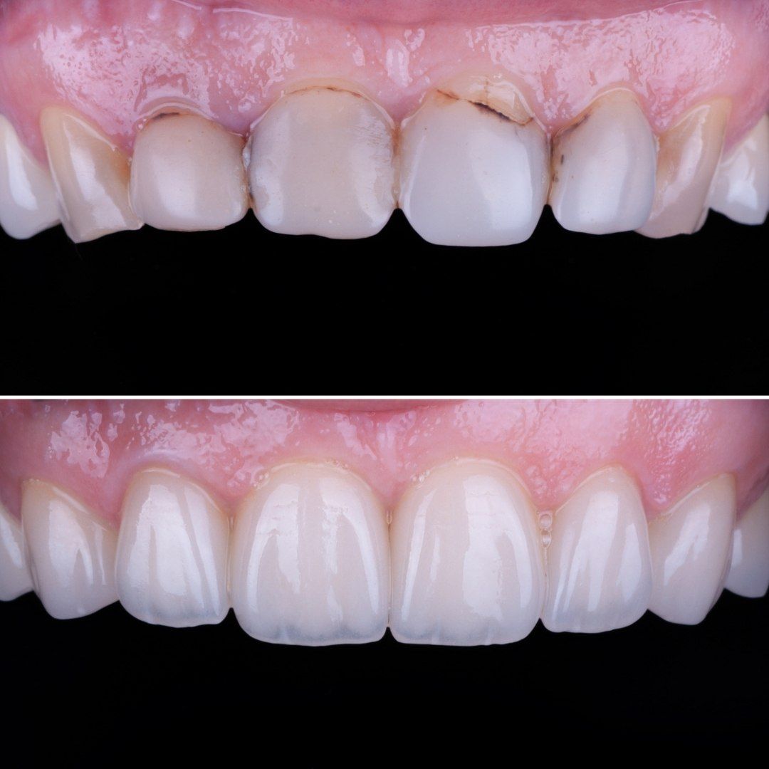 Esmeralda Candida Guerrero Pimentel-10