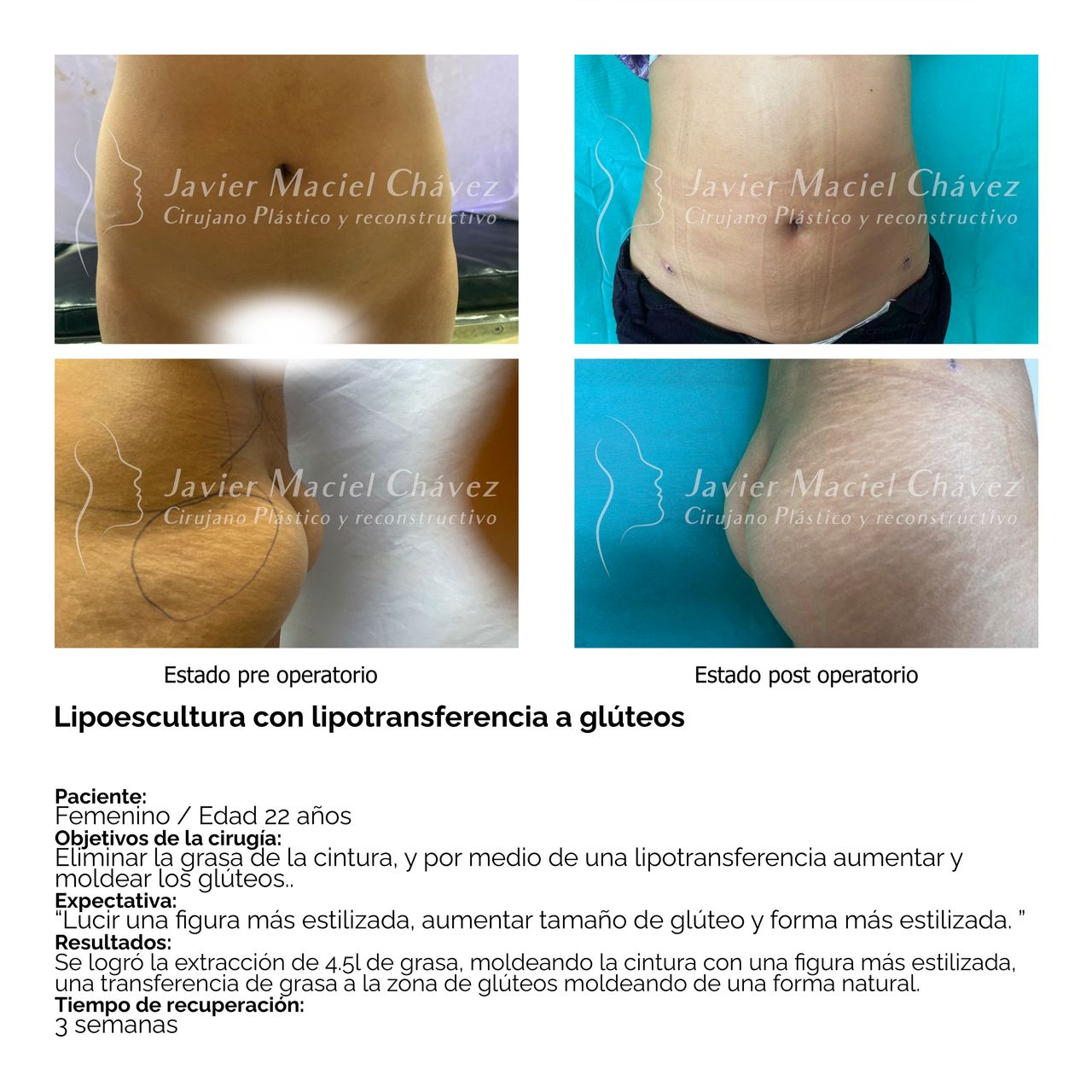 Javier Maciel Chávez-31