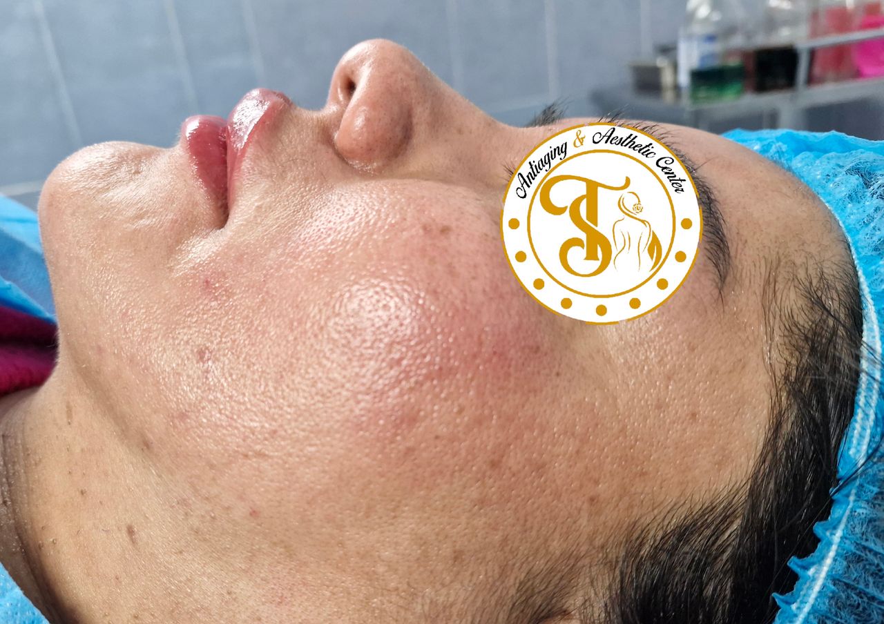 Samuel Torres Torres-9