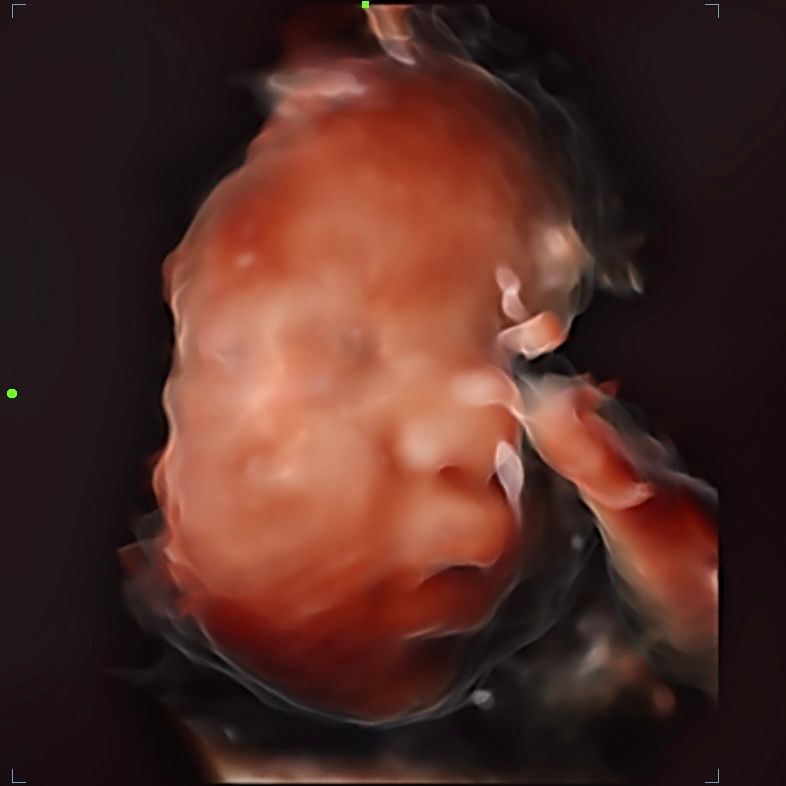 Daniela Villanueva Garza-16