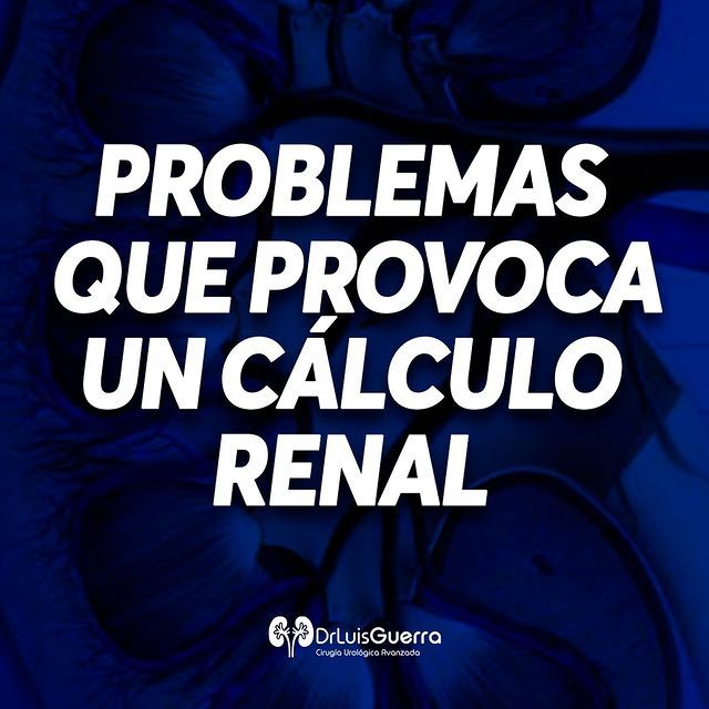 Luis Alberto Guerra Zepeda-166