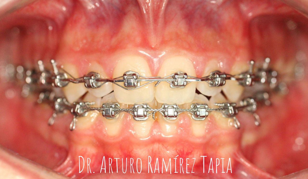 Arturo Ramírez Tapia-8