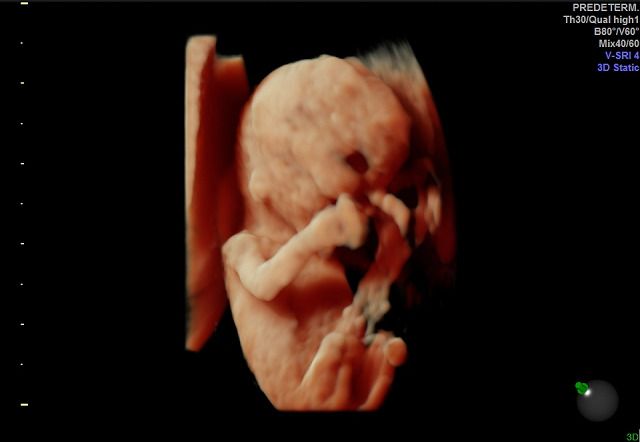 Graciela Elizabeth De La Torre Alvarez-16