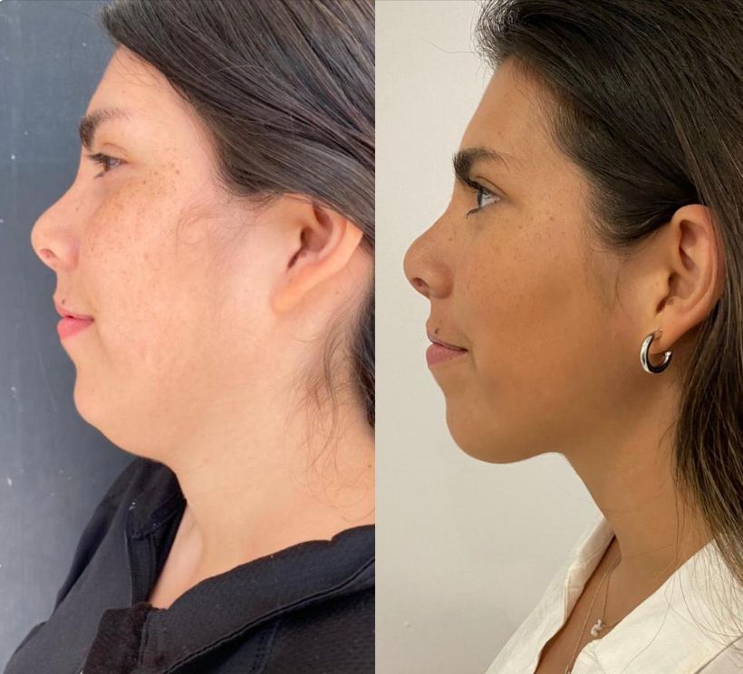 Elsa Sánchez Robles-22