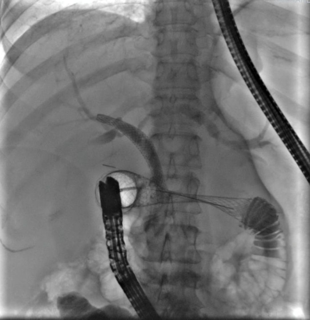 Everardo Muñoz Anaya-8