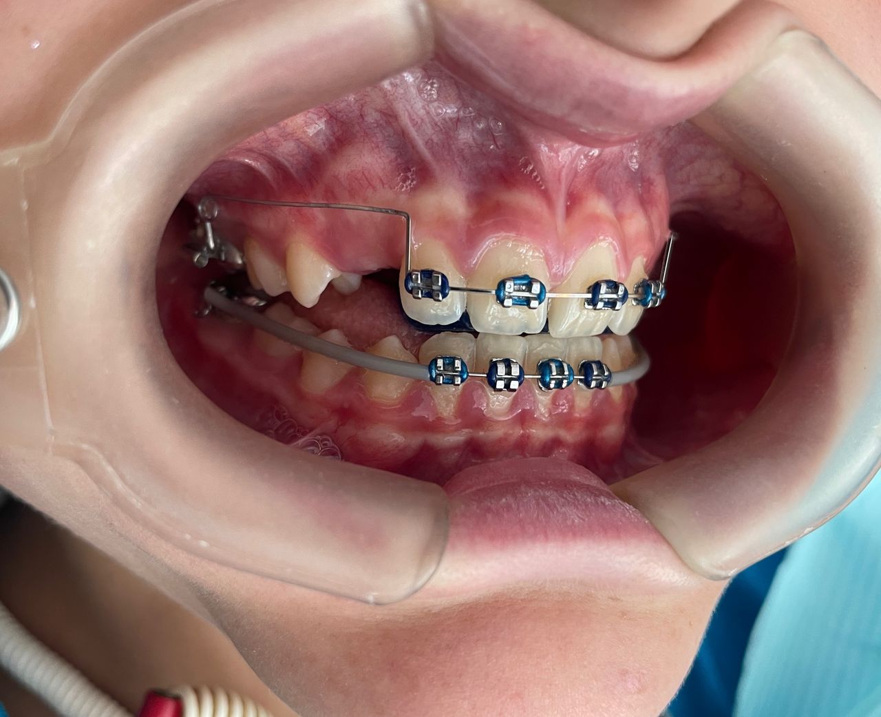 Luis Ernesto Calva Valdez-3